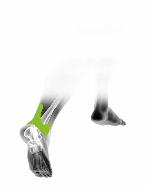 FIT THERAPY ANKLE PATCH (3 PATCHES PER PACK)