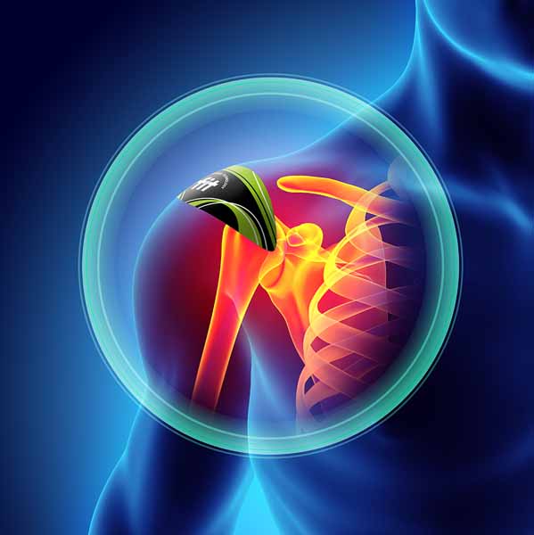 FIT THERAPY SHOULDER PATCH