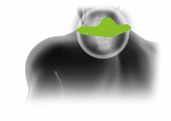FIT THERAPY NECK PATCH (3 PATCHES PER PACK)