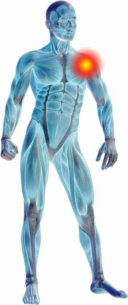 FIT THERAPY SHOULDER PATCH (3 PATCHES PER PACK)