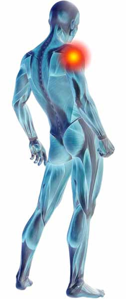 FIT THERAPY SHOULDER PATCH (3 PATCHES PER PACK)